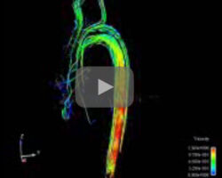 Week 3: Heart and Blood Physics