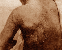 Week 9: Protein and Coconut Oil for Healing and Regeneration